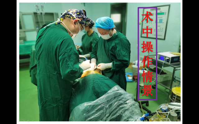 ACDF微创小切口治疗颈髓损伤+颈椎间盘突出症