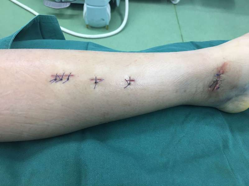 354770365513903503.jpg 354770365513903503.jpg